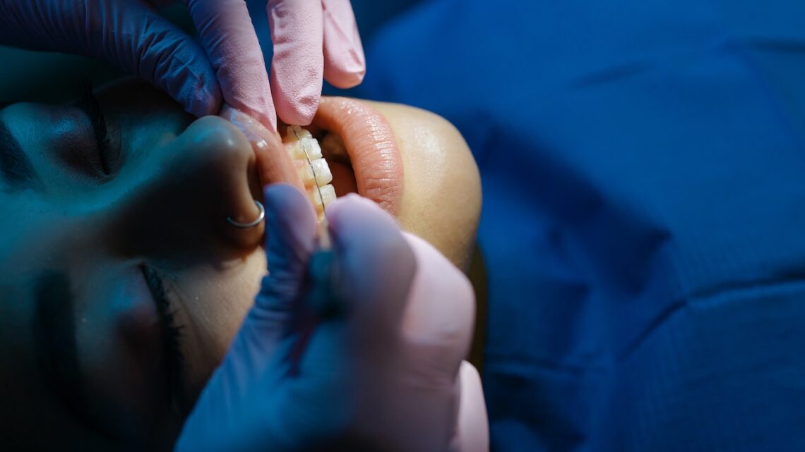 Czym zajmuje się ortodonta i kiedy się do niego udać?