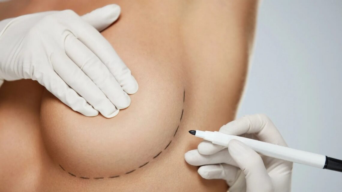Powiększanie piersi w klinice plastycznej