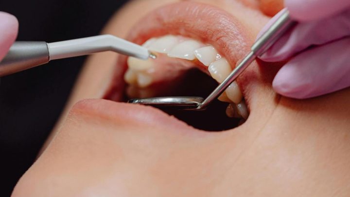 Ile trwa leczenie kanałowe i co wpływa na jego długość?